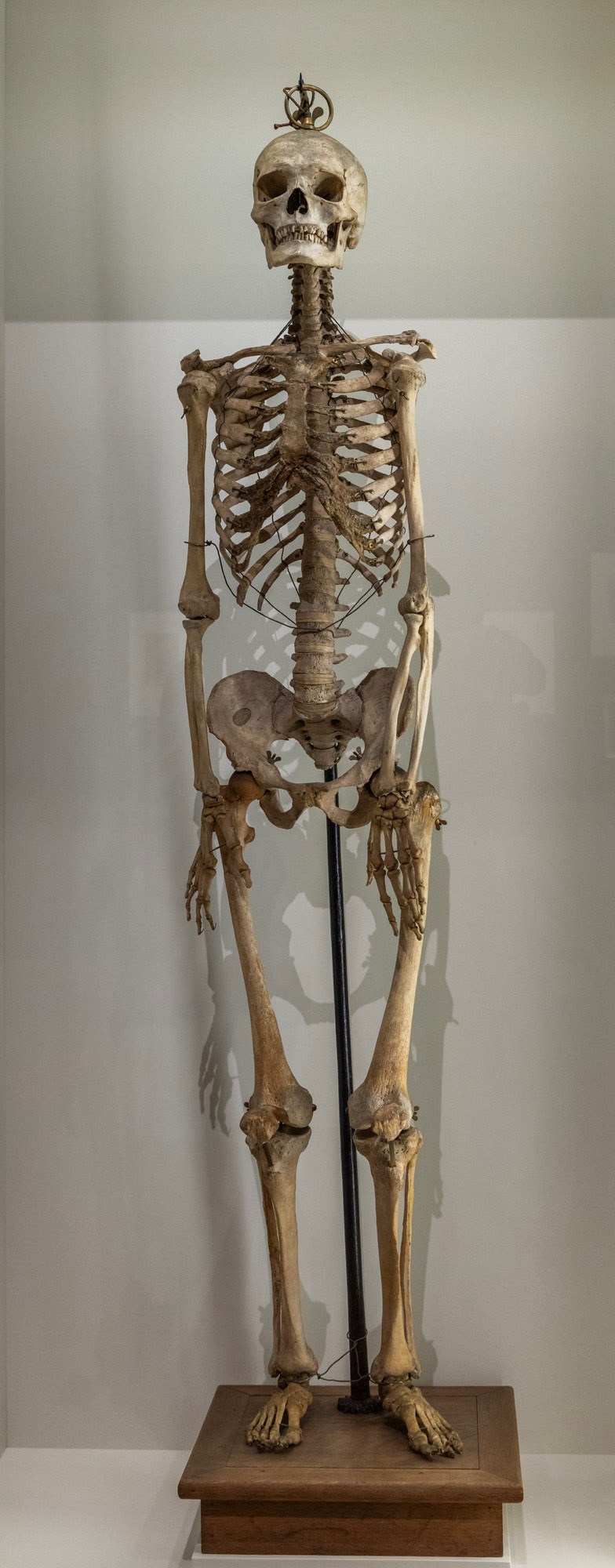 A human skeleton mounted on a plinth, used for anatomical study. On loan from the Norwegian Museum of Technology. Reflects Munch’s interest in anatomy, a recurring motif in his work. The bones show signs of age, with some dark discolouring to the rib cage.