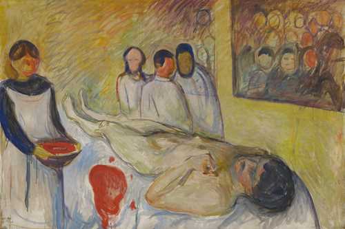 A man on the operation table, on his back, with the head towards the lower right corner. On the left hand side you see a nurse and in the back of the painting you see a group of three doctors.
